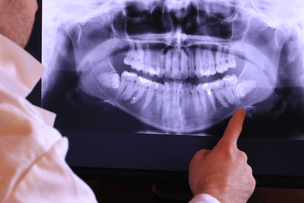 Best Emergency Treatment for Toothache in Marion, AL