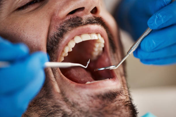 Best Walk-In Emergency Dentist in Marion, AL